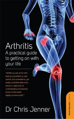 DR Chris Jenner Arthritis