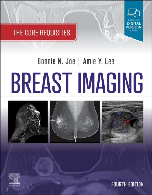 Elsevier - Health Sciences Division Breast Imaging : The Core Requisites