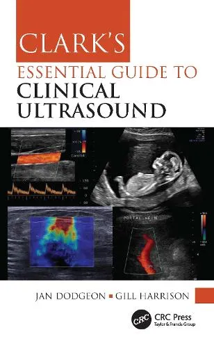 Jan Dodgeon Clark's Essential Guide to Clinical Ultrasound