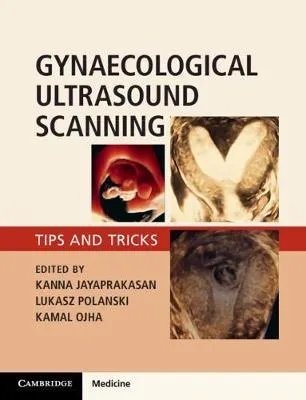 Kanna Jayaprakasan Gynaecological Ultrasound Scanning