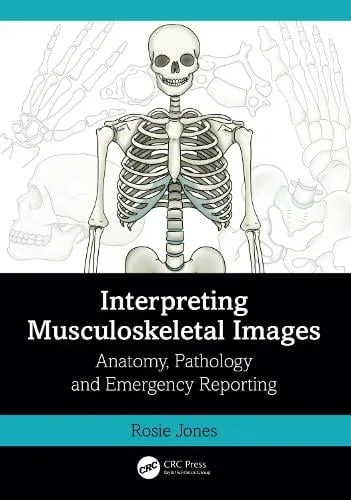Rosie Jones Interpreting Musculoskeletal Images